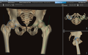 Ortoma Plan™ med 3D-visualisering